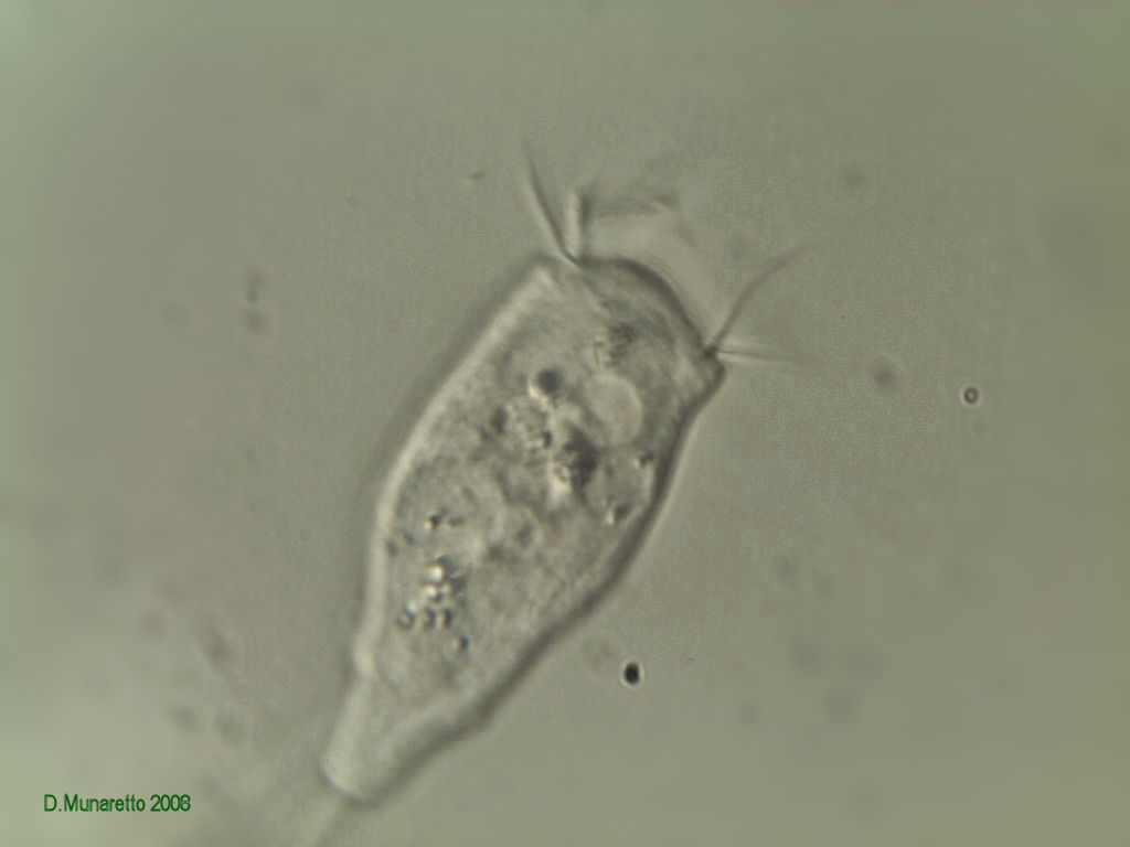 Vorticella in varie fasi di apertura